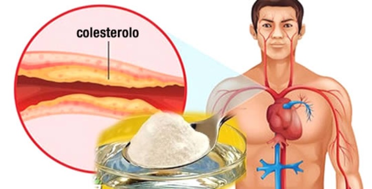 In che cosa consiste il colesterolo